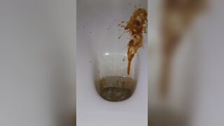 diarrhea with big spray, ScatKings.com Scat Porn 27 ScatKings.com Scat Porn